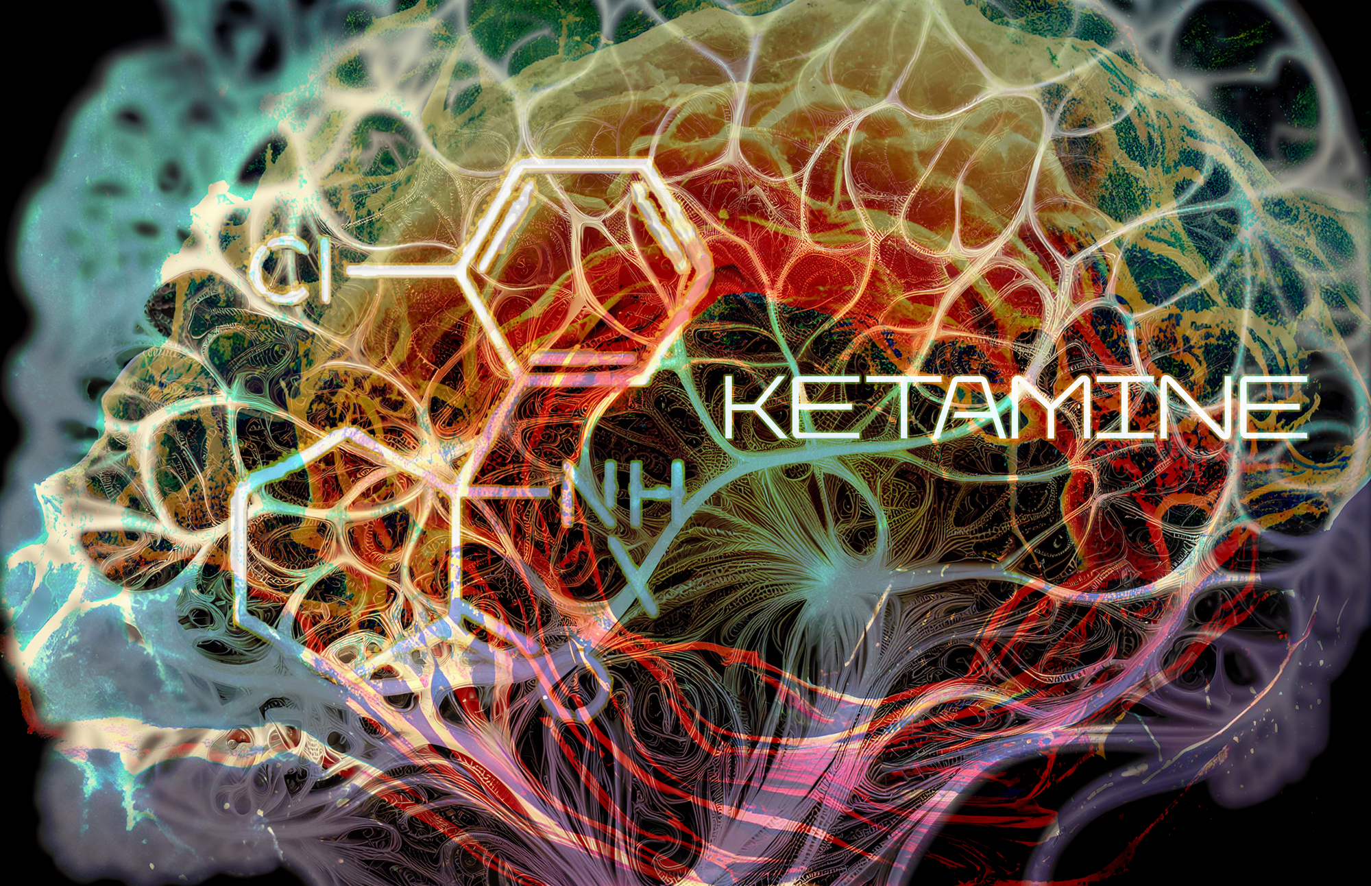 NRx Pharmaceuticals Plans to Spin Off Ketamine-Focused Company